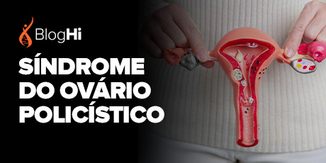 Síndrome do Ovário Policístico