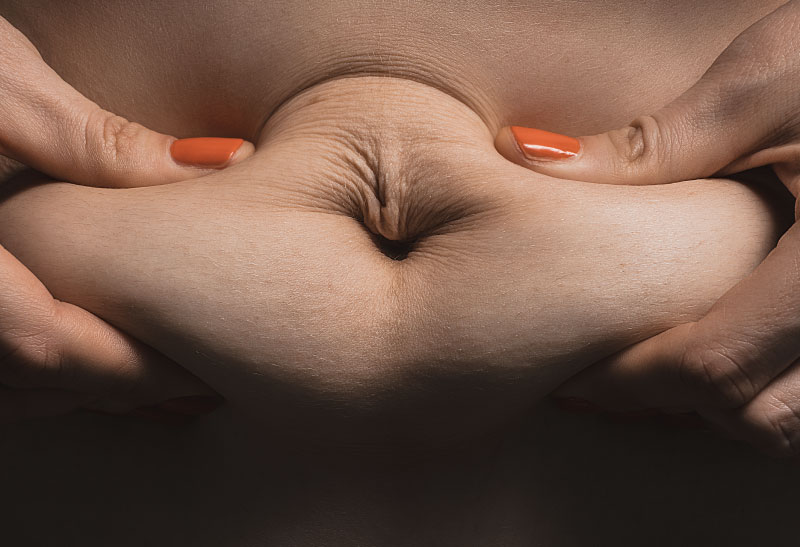 Dieta para evitar a flacidez