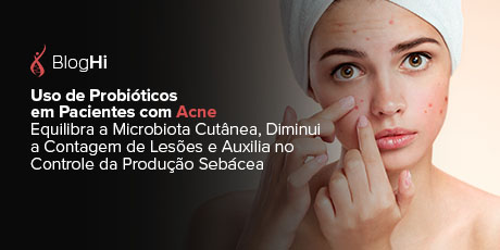 Uso de Probióticos em Pacientes com Acne Equilibra a Microbiota Cutânea, Diminui a Contagem de Lesões e Auxilia no Controle da Produção Sebácea